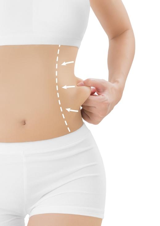 Flanks - Body Contouring - Laser And Facial Med Spa
