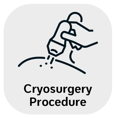 Cryosurgery in Monroe, LA and Southlake, TX