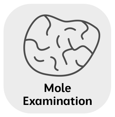 Mole Removal & Examinations in Monroe, LA and Southlake, TX