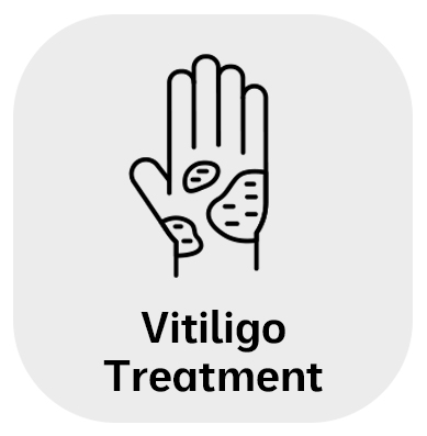 Vitiligo Treatment in Monroe, LA and Southlake, TX