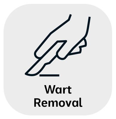 Wart Removal in Monroe, LA and Southlake, TX